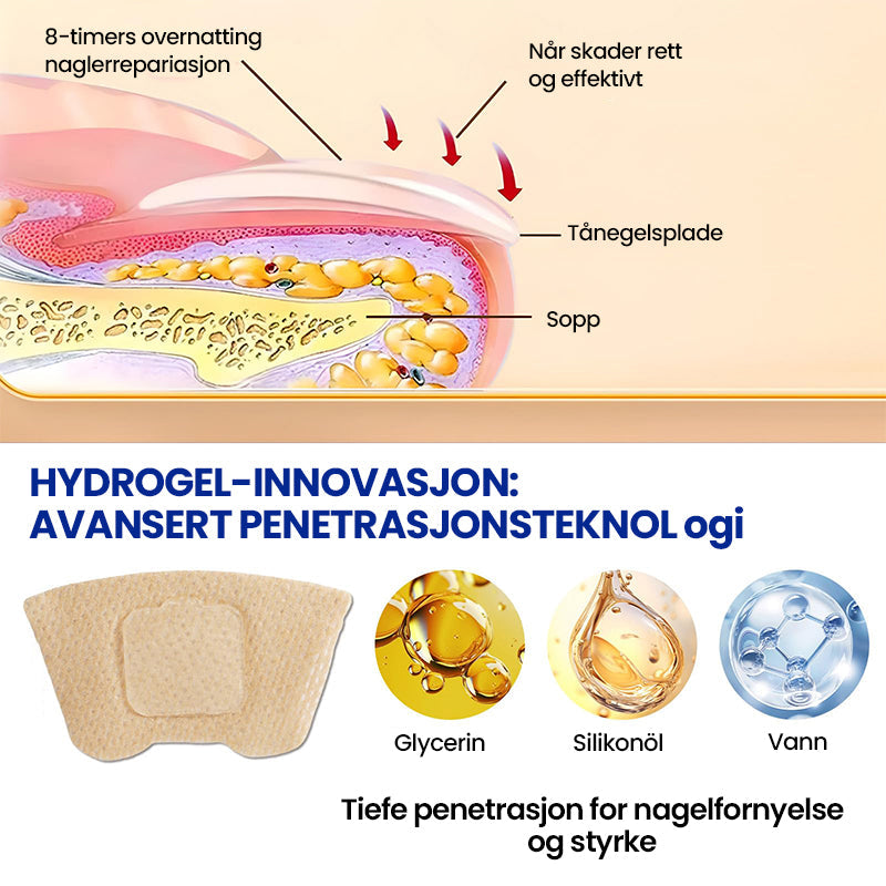 Sopplapper mot negler