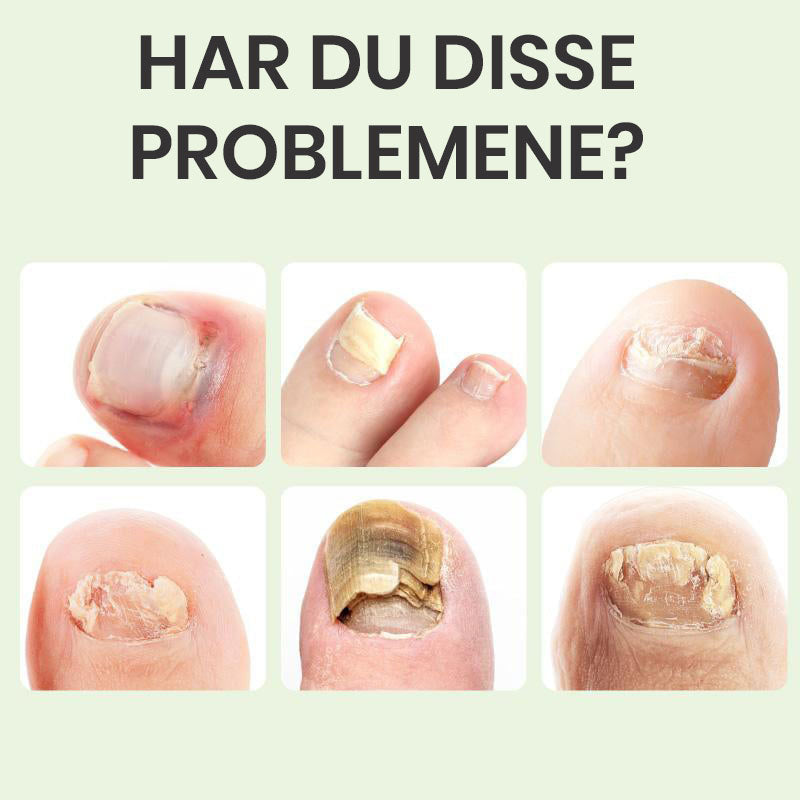 Magic Drops for neglereparasjon