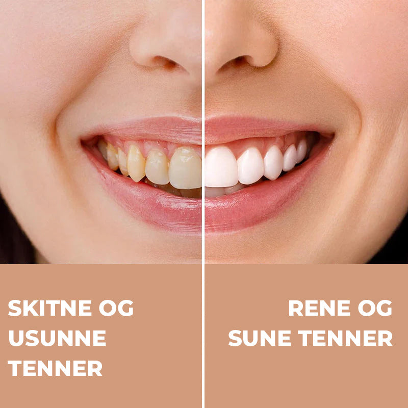 Hydroxyapatitt tannkrem