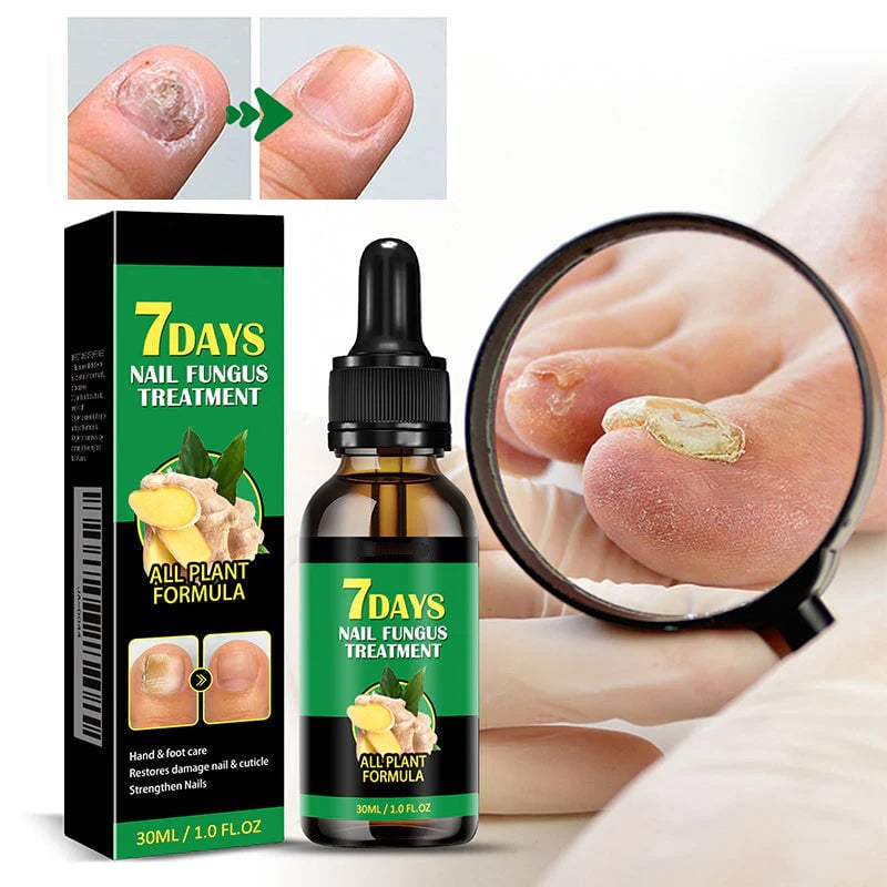 Ingefær neglebehandling