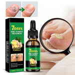 Ingefær neglebehandling