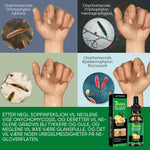 Ingefær neglebehandling