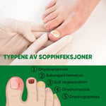 Ingefær neglebehandling