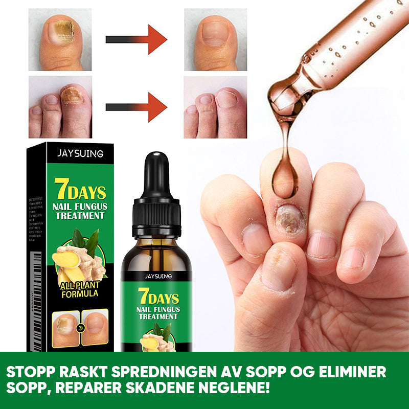 Ingefær neglebehandling