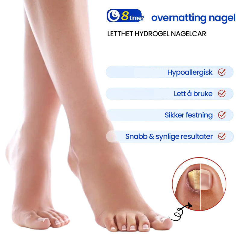 Sopplapper mot negler