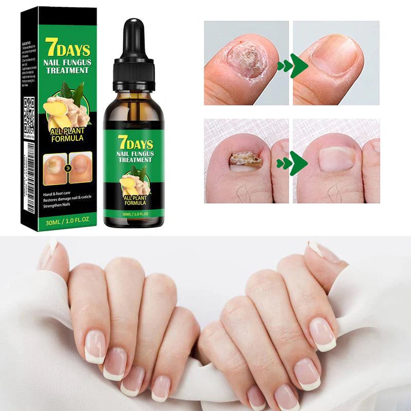 Ingefær neglebehandling